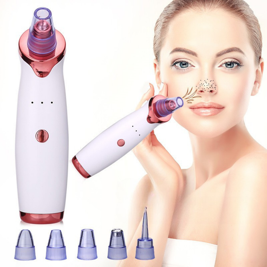 Blackhead Remover Vacuum for Deep Pore Cleansing – Effective Acne and Impurity Removal Device 0