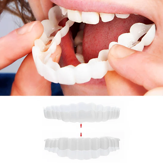 Smile Veneers Set for Upper and Lower Teeth – Medical Grade Silicone Clip-On Veneers for Instant Smile Transformation 0