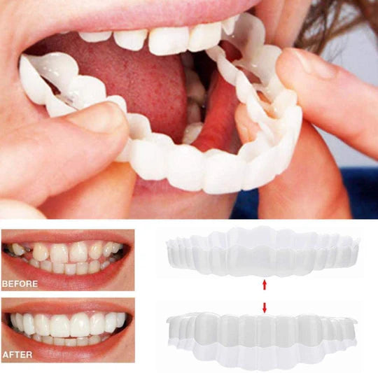 Smile Veneers Set for Upper and Lower Teeth – Medical Grade Silicone Clip-On Veneers for Instant Smile Transformation 2