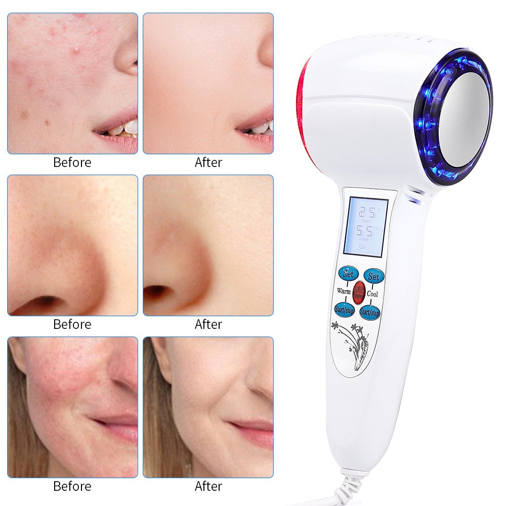 TRUZENIC At-Home Facial Cryotherapy Device