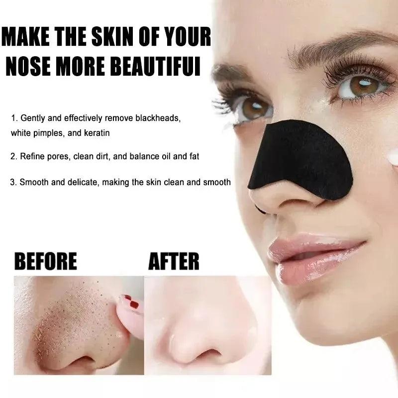 Blackhead Removal Strips – Deep Cleansing Pore Care for Fresh, Clear Skin-TRUZENIC