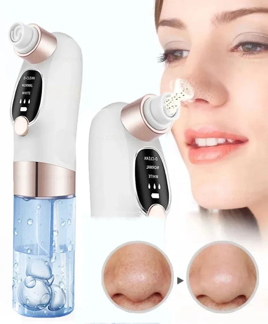 Pore Vacuum and Blackhead Remover – Electric Acne & Pimple Extractor with Water Circulation, USB Rechargeable Face Cleaner-TRUZENIC
