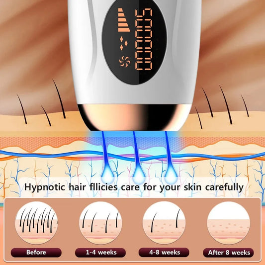 Laser Hair Removal At-Home IPL Hair Remover for Body, Face, Legs & Bikini Line-TRUZENIC