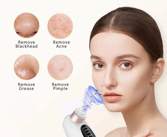 Pore Vacuum and Blackhead Remover – Electric Acne & Pimple Extractor with Water Circulation, USB Rechargeable Face Cleaner-TRUZENIC