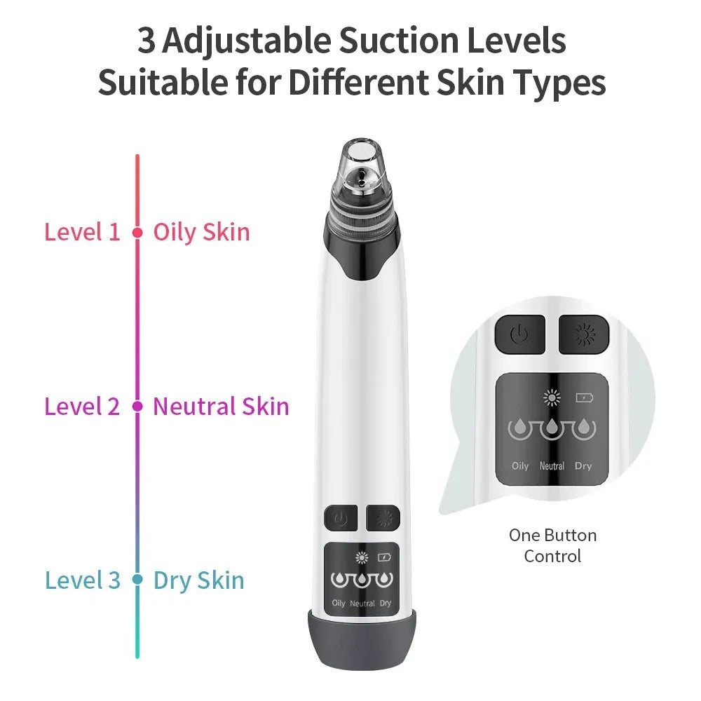 Hot Compress Blackhead Remover – Electric Pore Vacuum Cleaner for Nose & Face, Acne Suction & Deep Cleansing Skincare Device-TRUZENIC
