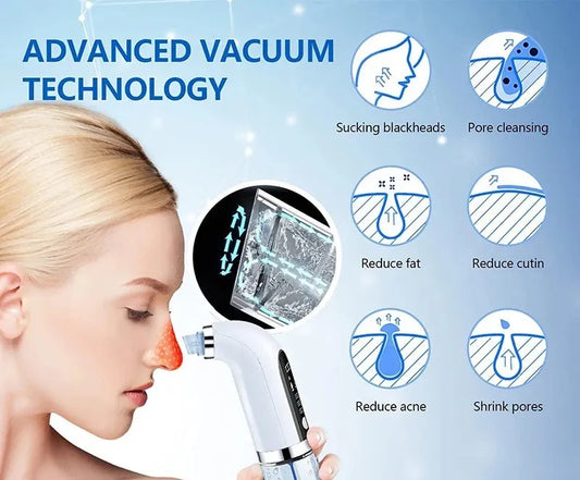 Blackhead Remover & Pore Vacuum – USB Rechargeable Micro Bubble Facial Cleansing Beauty Device-TRUZENIC