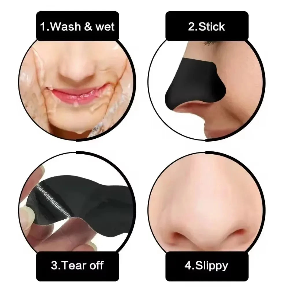 Blackhead Removal Strips – Deep Cleansing Pore Care for Fresh, Clear Skin-TRUZENIC