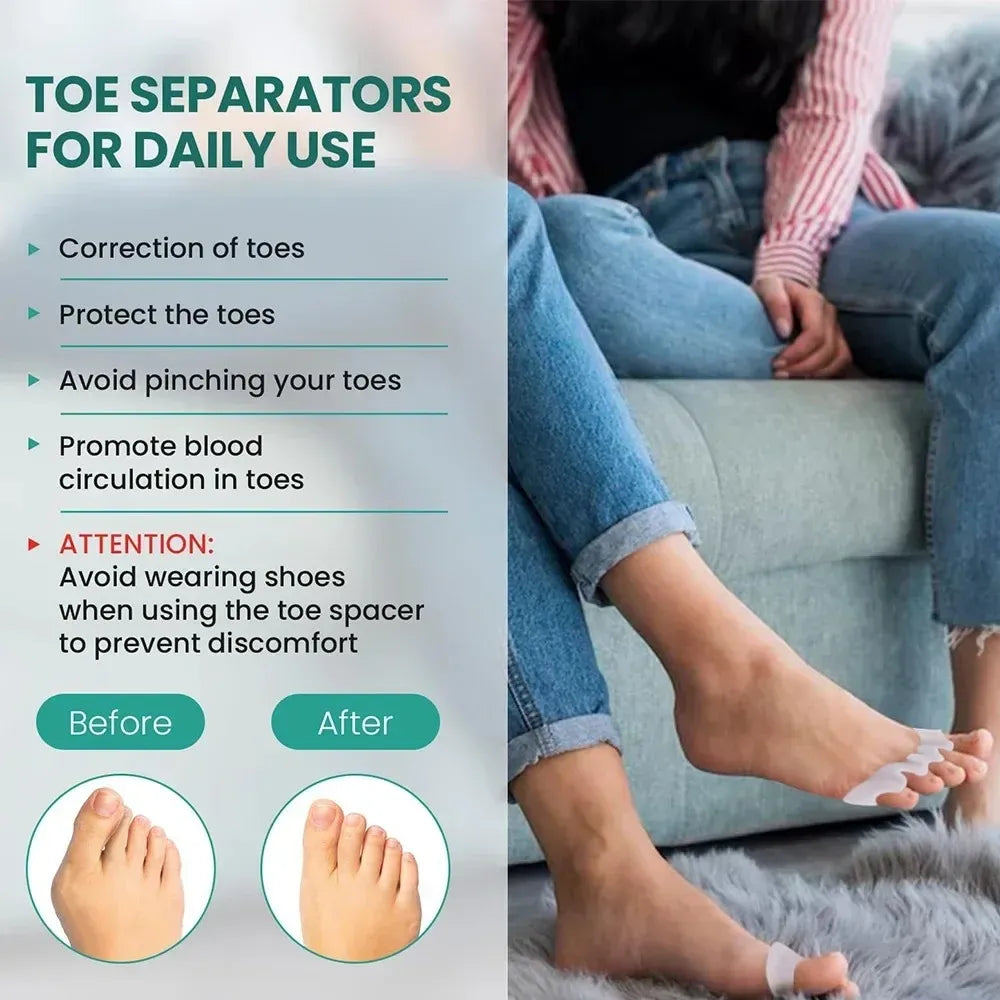 Silicone Toe Separators – Soft Gel Spacers for Toe Alignment and Daily Foot Comfort-TRUZENIC