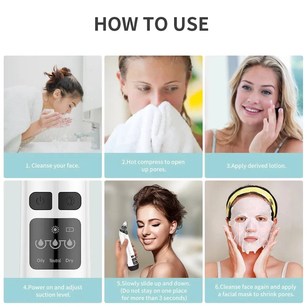 Hot Compress Blackhead Remover – Electric Pore Vacuum Cleaner for Nose & Face, Acne Suction & Deep Cleansing Skincare Device-TRUZENIC