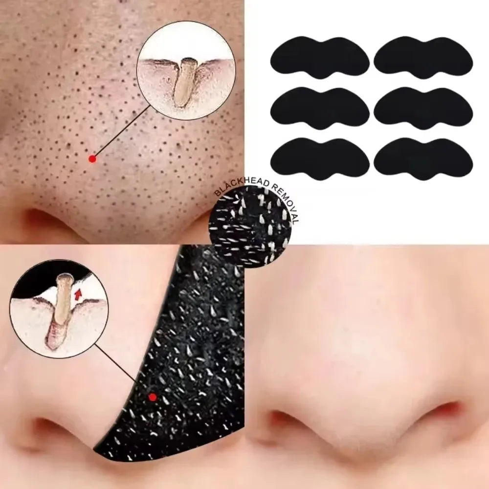 Blackhead Removal Strips – Deep Cleansing Pore Care for Fresh, Clear Skin-TRUZENIC