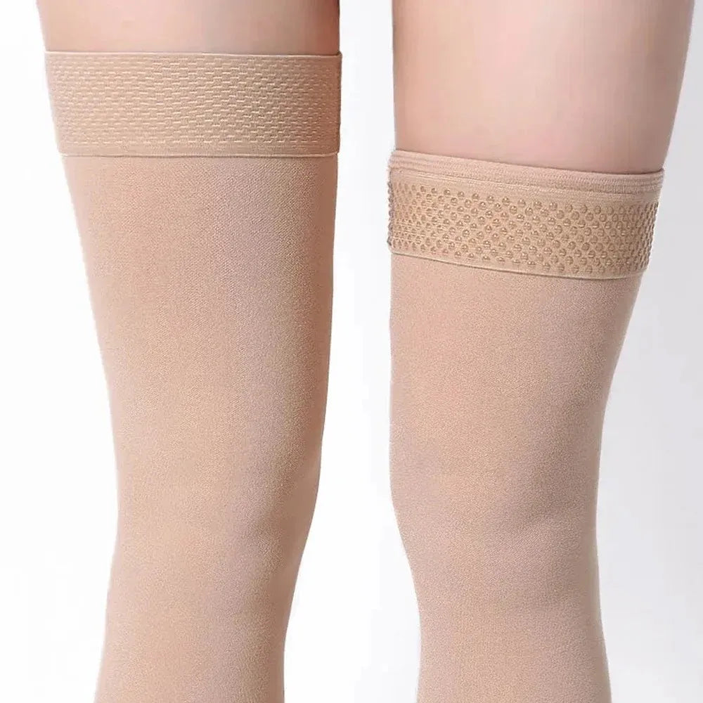 Thigh High Compression Stockings – Toeless Support Socks for Men & Women, Ideal for Travel & Daily Wear-TRUZENIC
