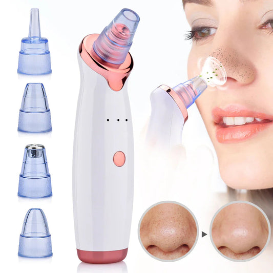 Blackhead Remover Vacuum for Deep Pore Cleansing – Effective Acne and Impurity Removal Device 1