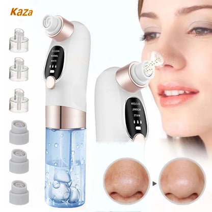TRUZENIC Electric Pore Vacuum – USB Rechargeable Facial Cleanser for Smooth Skin