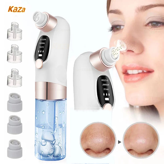 TRUZENIC Electric Pore Vacuum – USB Rechargeable Facial Cleanser for Smooth Skin