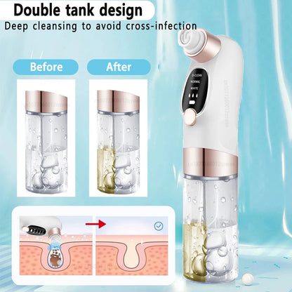 TRUZENIC Electric Pore Vacuum – USB Rechargeable Facial Cleanser for Smooth Skin