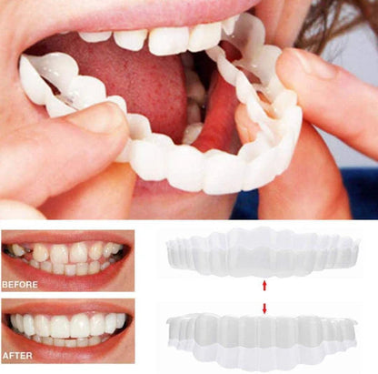 Smile Veneers Set for Upper and Lower Teeth – Medical Grade Silicone Clip-On Veneers for Instant Smile Transformation 2
