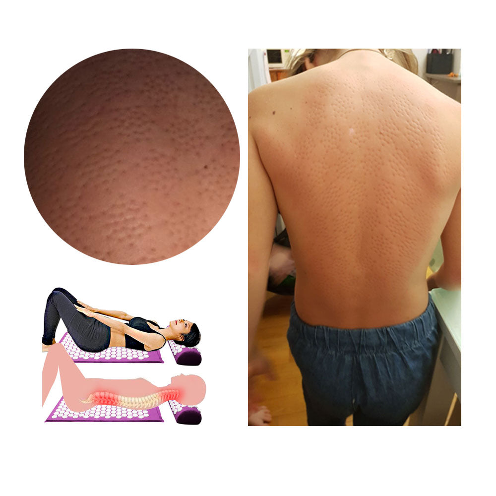 TRUZENIC Acupressure Yoga Mat