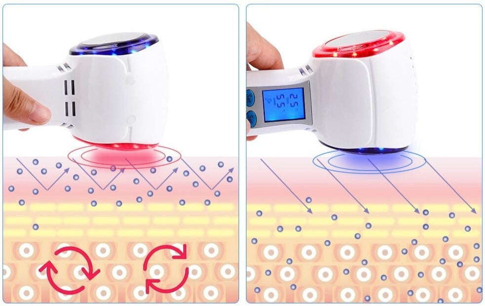 TRUZENIC At-Home Facial Cryotherapy Device