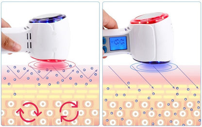 TRUZENIC At-Home Facial Cryotherapy Device