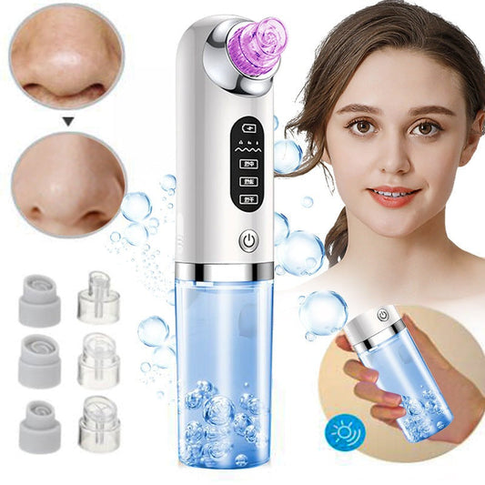TRUZENIC Hydro Microdermabrasion Blackhead Remover