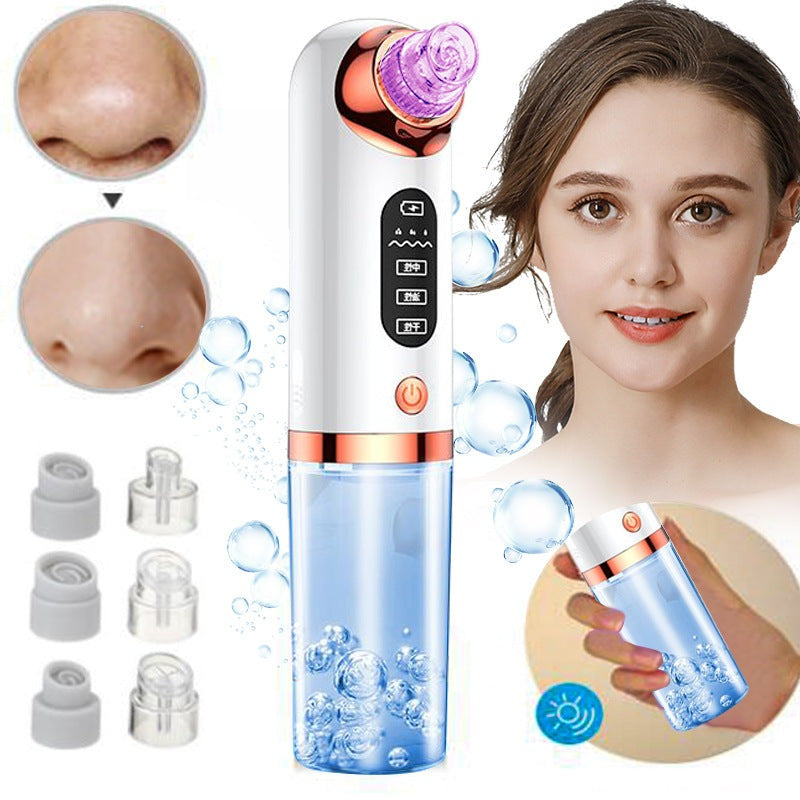 TRUZENIC Hydro Microdermabrasion Blackhead Remover