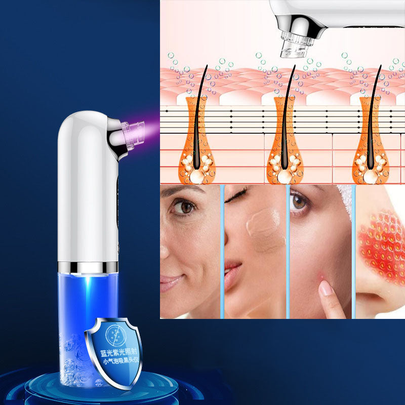TRUZENIC Hydro Microdermabrasion Blackhead Remover