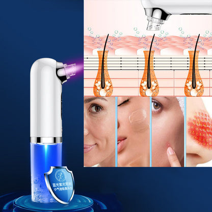 TRUZENIC Hydro Microdermabrasion Blackhead Remover