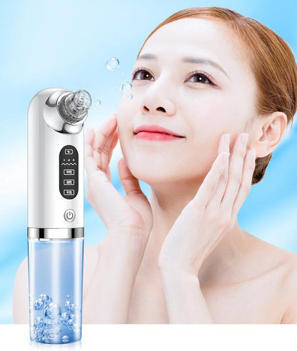TRUZENIC Hydro Microdermabrasion Blackhead Remover