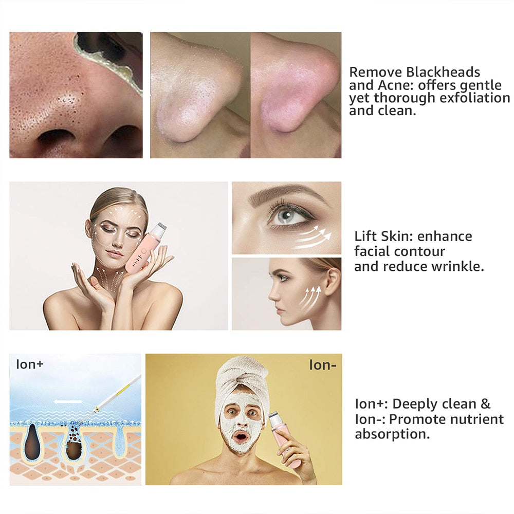 TRUZENIC Ultrasonic Skin Scrubber