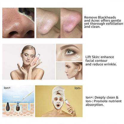 TRUZENIC Ultrasonic Skin Scrubber