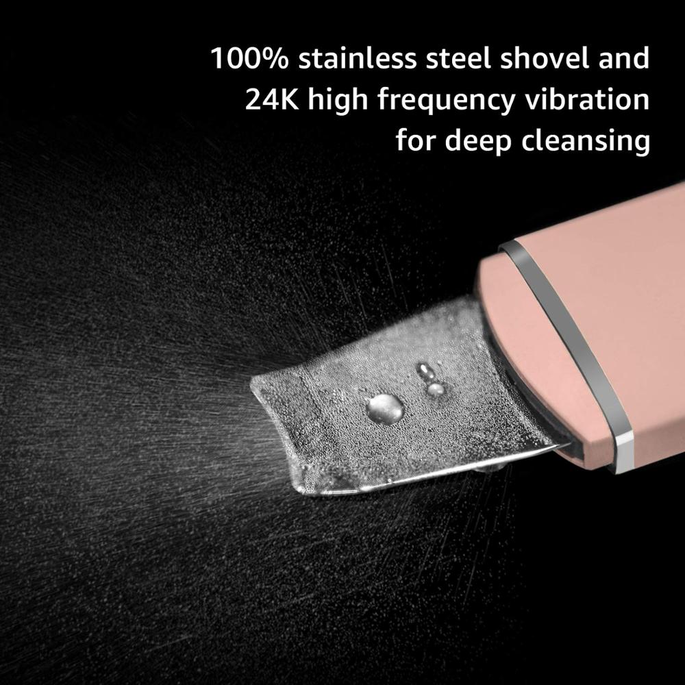 TRUZENIC Ultrasonic Skin Scrubber