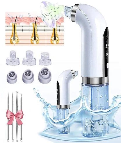 Blackhead Remover & Pore Vacuum – USB Rechargeable Micro Bubble Facial Cleansing Beauty Device-TRUZENIC