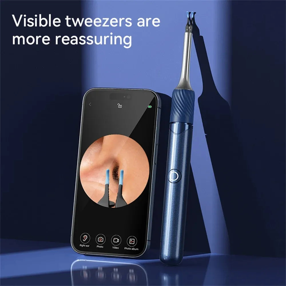 Visual Ear Cleaner with Camera – Ear Wax Removal Tool-TRUZENIC