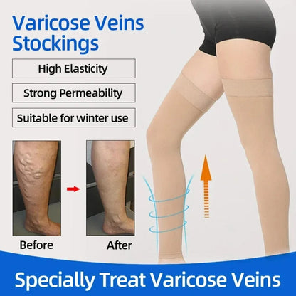 Thigh High Compression Stockings – Toeless Support Socks for Men & Women, Ideal for Travel & Daily Wear-TRUZENIC