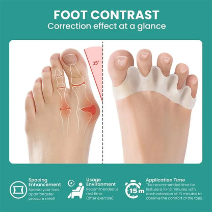 Silicone Toe Separators – Soft Gel Spacers for Toe Alignment and Daily Foot Comfort-TRUZENIC