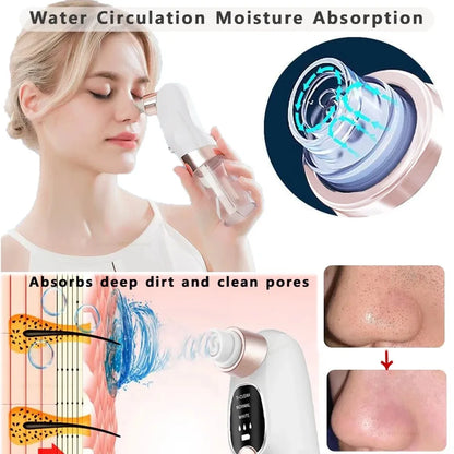 Pore Vacuum and Blackhead Remover – Electric Acne & Pimple Extractor with Water Circulation, USB Rechargeable Face Cleaner-TRUZENIC