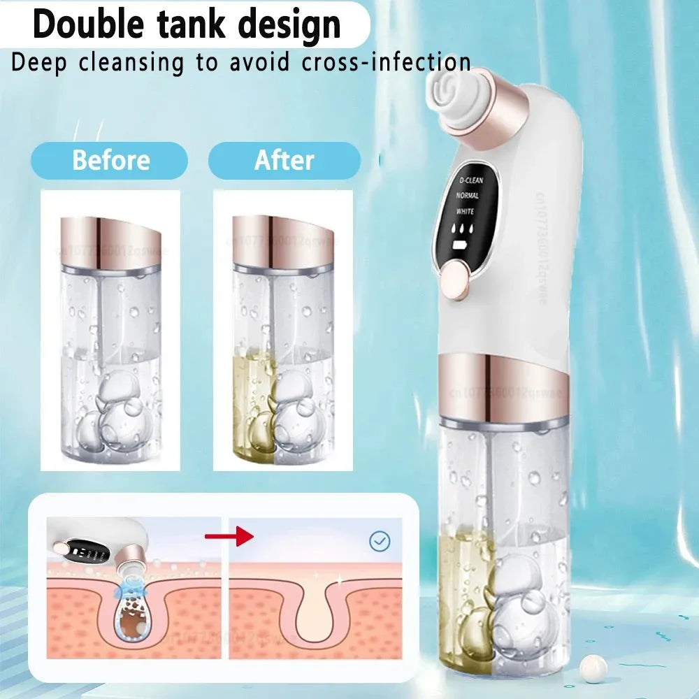 Pore Vacuum and Blackhead Remover – Electric Acne & Pimple Extractor with Water Circulation, USB Rechargeable Face Cleaner-TRUZENIC