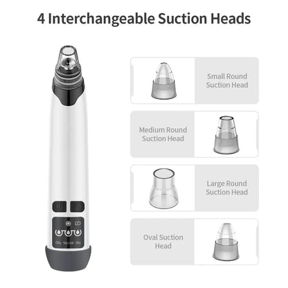 Hot Compress Blackhead Remover – Electric Pore Vacuum Cleaner for Nose & Face, Acne Suction & Deep Cleansing Skincare Device-TRUZENIC