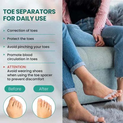 Silicone Toe Separators – Soft Gel Spacers for Toe Alignment and Daily Foot Comfort-TRUZENIC