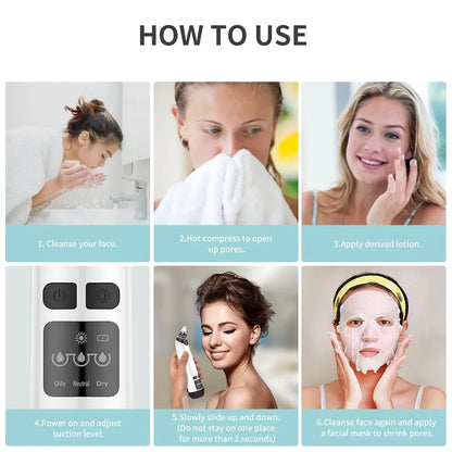 Hot Compress Blackhead Remover – Electric Pore Vacuum Cleaner for Nose & Face, Acne Suction & Deep Cleansing Skincare Device-TRUZENIC